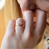 ring (175)